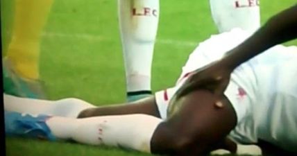 Mignolet injures Kolo Toure…then stupidly treads on his leg (Video)