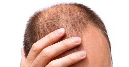 Men should avoid this one particular hairstyle because it makes you go bald…