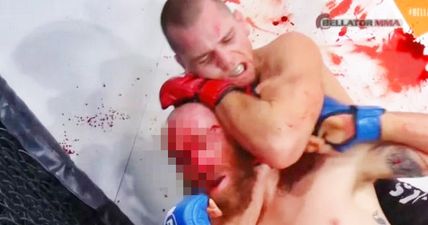 [GRAPHIC] Bellator 147 produces most gruesome rear-naked choke submission you will ever see