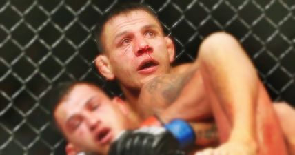 REVEALED: The details of the injury that has ruled Rafael dos Anjos out of UFC 196