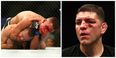 Are UFC taking a sly dig at Nate Diaz’s brother with his medical suspension?