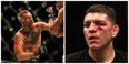 “This ain’t f**king Ireland” – Nick Diaz slates Conor McGregor’s training for UFC 196