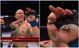 Josh Emmett wins UFC bout despite broken finger