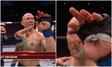 Josh Emmett wins UFC bout despite broken finger