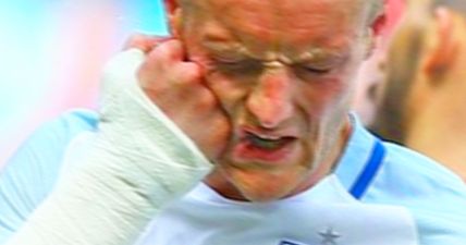 Vardy is so angry with himself for missing the target that he punches his own face