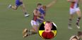 Aussie Rules starlet suffers gruesome double leg break by accidentally kicking himself