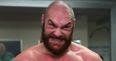 Tyson Fury facing anti-doping charge