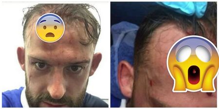 Steven Fletcher’s horrific head gash is not for the squeamish