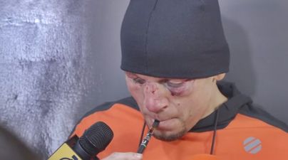 Nate Diaz cleared of taking cannabis by NSAC but could still face drugs ban