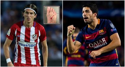 Luis Suarez tells Filipe Luis to stop moaning after leaving him with nasty stud mark