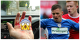 Irish striker suffers one of the most gruesome finger injuries we’ve ever seen