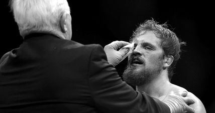 UFC Belfast loses main event as Gunnar Nelson suffers injury