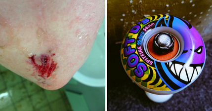 21 things you’ll remember if you skated as a teenager