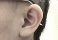 Here’s why some people have tiny extra holes above their ears