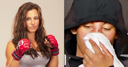 Miesha Tate shares painful looking selfie after nose surgery