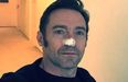 Hugh Jackman urges fans to wear sunscreen as he undergoes more treatment for skin cancer