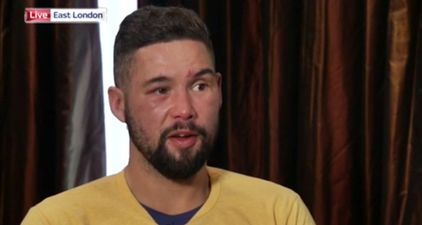 Tony Bellew displays his broken hand during interview after David Haye victory