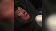 Here’s the full list of injuries that David Dao suffered after being dragged off the United Airlines flight