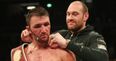 Hughie Fury has pulled out of his heavyweight title fight with Joseph Parker