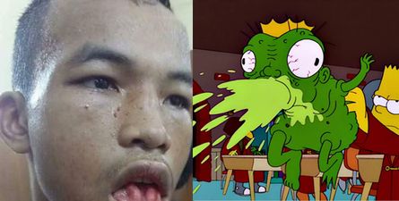 [GRAPHIC] Muay Thai injury will make you feel silly for ever believing that you’ve actually had a cut lip