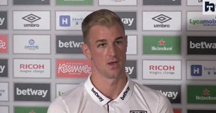 Joe Hart had a hilarious explanation for his black eye