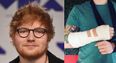 Ed Sheeran ‘rushed to hospital’ after being knocked off bike in London