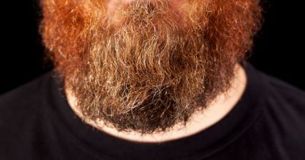 Ever wonder why some non-ginger men end up with ginger beards?