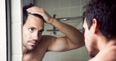 Noticed yourself losing more hair recently? Well, there’s no reason to panic