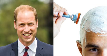 Prince William has finally bit the bullet and shaved his head