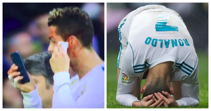 Cristiano Ronaldo uses phone as mirror to assess face injury, immediately walks off the pitch