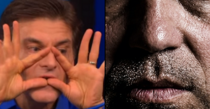 Dr Oz warns of “Triangle of Death” on our faces we need to know about