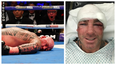 Lucas Browne posts recovery pics after brutal knockout from Dillian Whyte