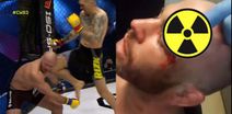 British MMA veteran suffers the most gruesome cut you’ll ever see