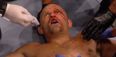 Chuck Liddell dead serious about taking arguably the most inadvisable fight imaginable