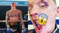 GRAPHIC: Mason Cartwright reveals the extent of horrific mouth injury suffered during Darren Tetley fight