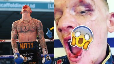 GRAPHIC: Mason Cartwright reveals the extent of horrific mouth injury suffered during Darren Tetley fight