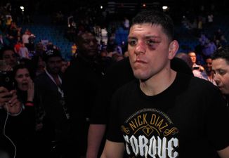 Nick Diaz’s mugshot released after assault arrest