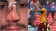 Motherwell captain faces disciplinary hearing for comments on Fabio Cardoso injury