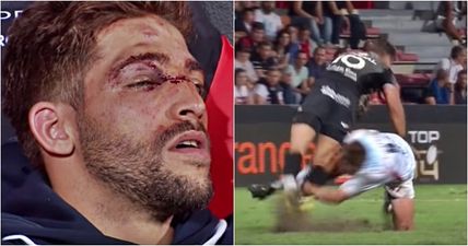 Scrum-half has face “rearranged” by brutal rugby tackle gone wrong