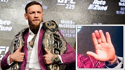 Conor McGregor explains mark on his finger ahead of UFC 229 title fight