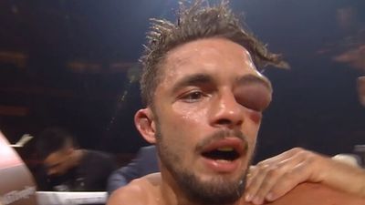 Anthony Yigit suffers brutal eye injury in defeat to Ivan Baranchyk