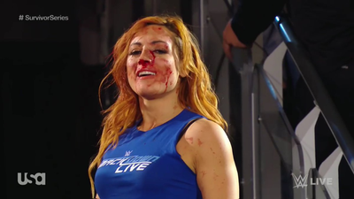 WATCH: WWE release an emotional video of Becky Lynch following her nasty injury last week