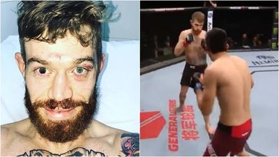 Gruesome eye injury picked up on UFC Argentina card