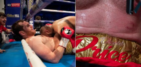 Boxer disqualified for biting David Price in bizarre heavyweight bout