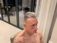 Phil Jones has grey hair now and it is spectacular