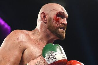 Tyson Fury’s cut against Otto Wallin a wake up call ahead of Wilder rematch