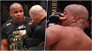 Daniel Cormier loses sight in his eye during controversial UFC 252 loss