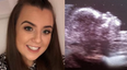 Virgin shocked to discover she’s pregnant