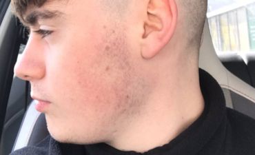 Guy left with ‘botched’ haircut after waiting four months for barbers to reopen