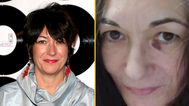 Ghislaine Maxwell pictured with a black eye in prison